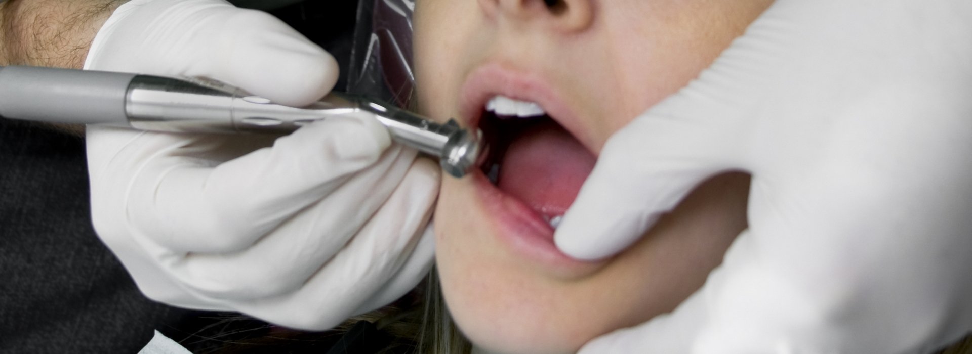 Dental treatments